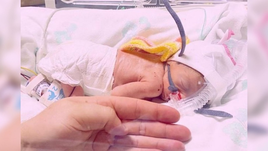 Newborn baby dies after 4month battle; parents were heartbroken, but